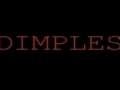 Dimples